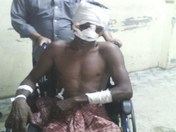 Shocking: Son cut off his Fathers nose Shocking: Son cut off his Fathers nose